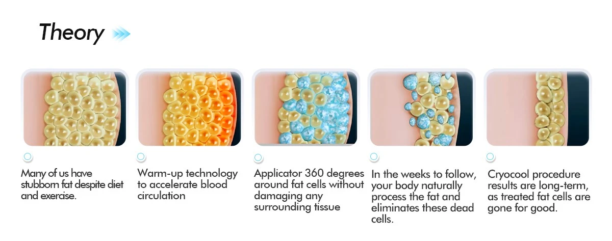 Cryolipolysis Slimming Machine Cryolipolysis Slimming Machine